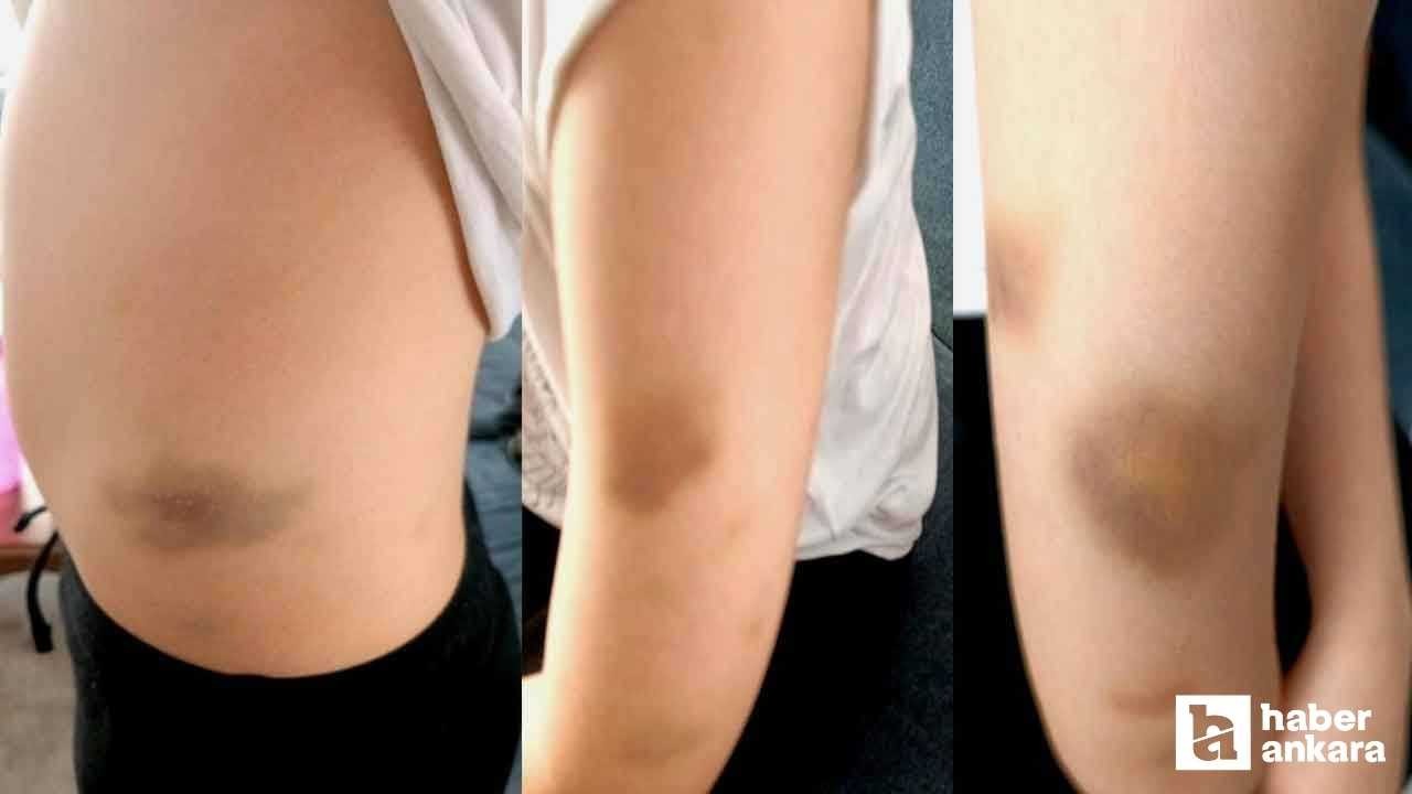 Çankaya'da özel okulda akran şiddeti iddiası