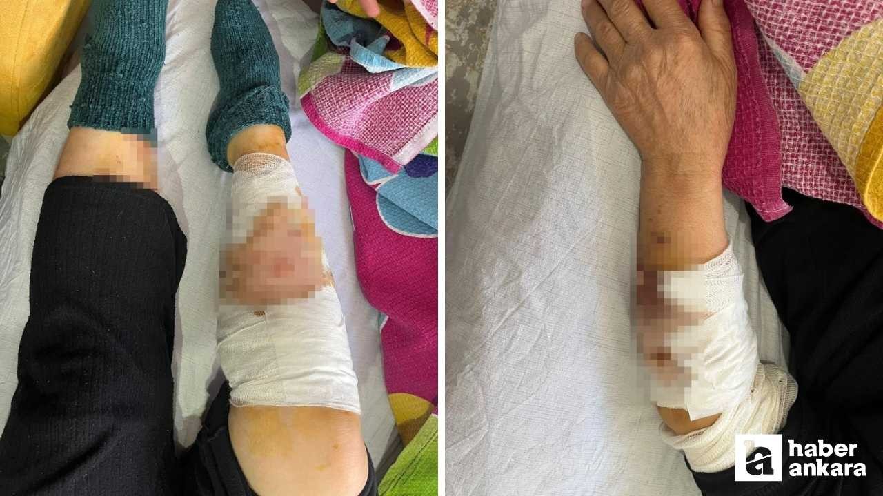 Ayaş'ta köpek saldırısına uğrayan yaşlı kadın ağır yaralandı!