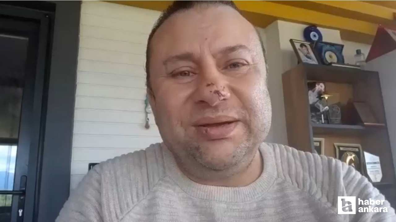 Pitbull saldırısına uğrayan Onur Akay, 1,5 gün yoğun bakımda tedavi edildi