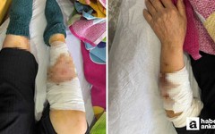 Ayaş'ta köpek saldırısına uğrayan yaşlı kadın ağır yaralandı!