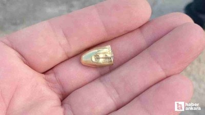 Akyurt'ta yorgun merminin isabet ettiği yaşlı kadın yaralandı