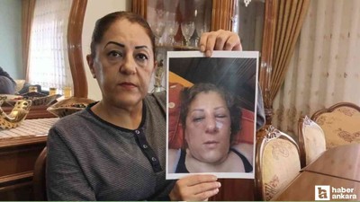 Yenimahalle'de komşular arasında kedi besleme kavgası!