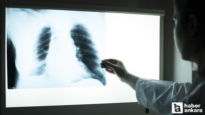 50 yaş üstü sigara tiryakilerine uyarı: Mutlaka yaptırın!