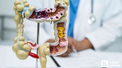 Safra kesesi taşları erken evrede kolayca tedavi edilebiliyor