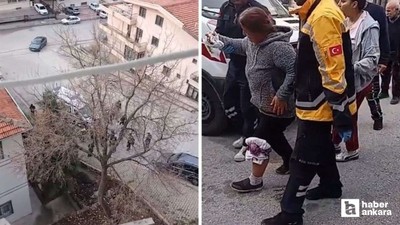 Yenimahalle'de markete giderken köpeklerin saldırdığı kadın yaralandı