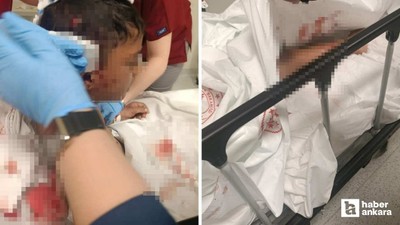 Altındağ'da 8 yaşındaki çocuğa okul dönüşü sokak köpeği saldırısı