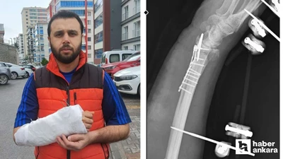 Mamak'ta sahipsiz köpeklerden kaçmaya çalışan adam bileğini kırdı