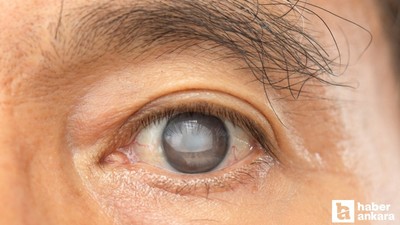 Geçen yıl 750 bin kişiye göz tansiyonu tanısı konuldu
