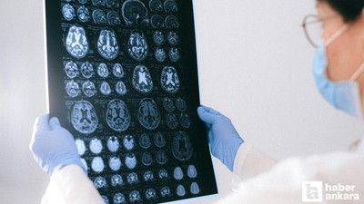 D vitamin seviyesi ve Alzheimer arasında ilişki olabilir