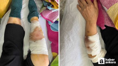 Ayaş'ta köpek saldırısına uğrayan yaşlı kadın ağır yaralandı!
