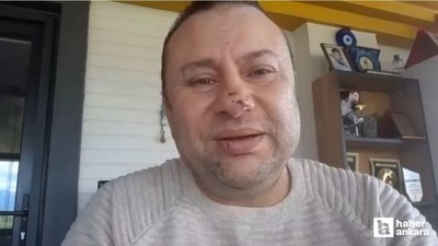 Pitbull saldırısına uğrayan Onur Akay, 1,5 gün yoğun bakımda tedavi edildi