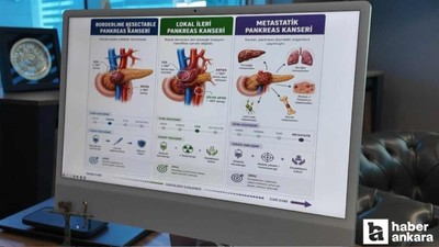 Pankreas kanserinde büyük başarı: Tedavi edilemez denen hastalara yeni umut!