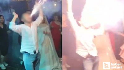 Pursaklar'da düğünde ağzında meşale patlayan genç yüzünden yaralandı