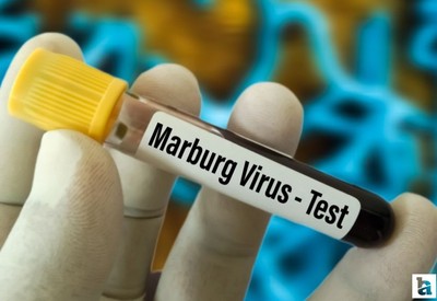 Marburg virüsü 8 kişinin ölümüne sebep oldu: Belirtiler nedir?