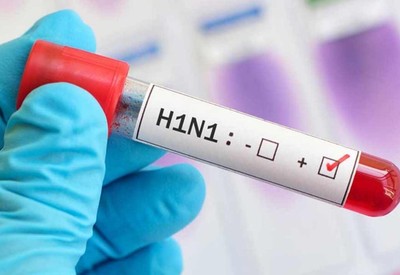 Domuz gribi pik yaptı: 65 yaş üstü, çocuklar ve kronik hastalara maske uyarısı!