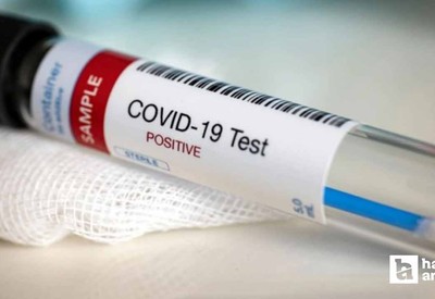 Kovid-19'un yeni "LP.8.1" varyantı Avustralya'da hızla yayılıyor
