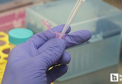 ALS hastalığının tedavisinde yeni umut: İlerleme durdurulacak!