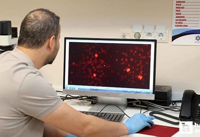 Türk bilim insanlarından Alzheimer hastalığını erken evrede yakalayacak çalışma!