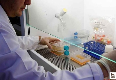 Prostat kanseri, erkeklerde en çok görülen ikinci kanser türü oldu