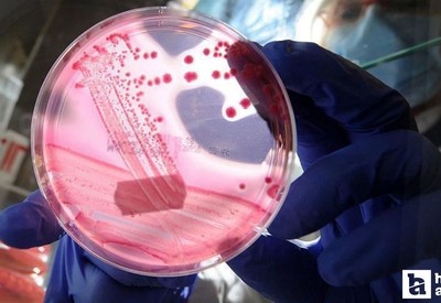 Ailesinde prostat kanseri olanlara meme kanseri uyarısı!