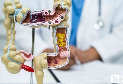 Safra kesesi taşları erken evrede kolayca tedavi edilebiliyor