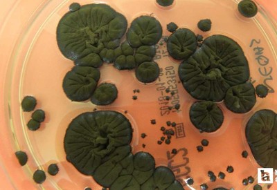 Çernobil’de radyasyon yiyen mantar keşfedildi