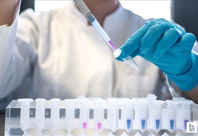 DSÖ açıkladı: 2024 yılında 1,3 milyon kişi AIDS'e yakalandı