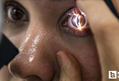 Yapay zeka nedeniyle göz sağlığı tedavisi gecikiyor!