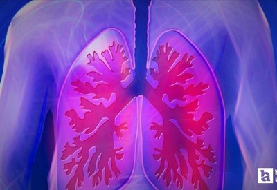 Ailesinde kanser geçmişi olanlara uyarı! Büyük risk altındasınız!