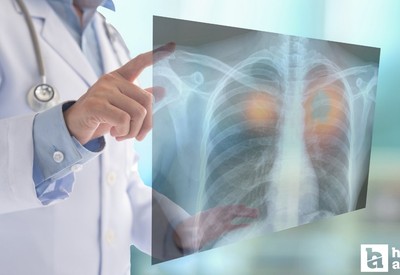 Yozgat'ta kanser taramaları ile kanserin erken teşhis edilmesi amaçlanıyor