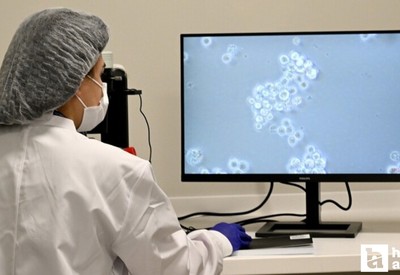 Etlik Şehir Hastanesi’nde kan kanseri hastalarına yönelik hücre tedavisi ilk kez uygulandı!