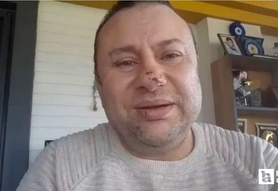 Pitbull saldırısına uğrayan Onur Akay, 1,5 gün yoğun bakımda tedavi edildi