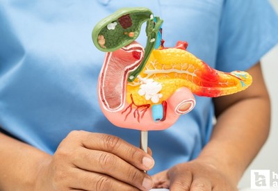 Uzmanlar obezite ve pankreas kanseri arasındaki ilişkiye dikkat çekti