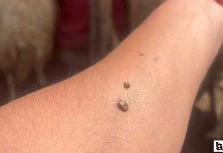 Ankaralılara uyarı: Felaket kene var, dikkatli olun!