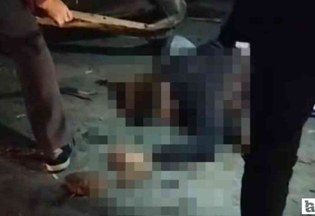 Sincan'da kontrolden çıkan araç bariyerlere çarptı! Sürücü ağır yaralı
