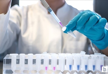 DSÖ açıkladı: 2024 yılında 1,3 milyon kişi AIDS'e yakalandı