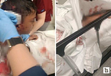 Altındağ'da 8 yaşındaki çocuğa okul dönüşü sokak köpeği saldırısı