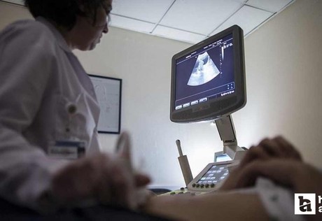 Her 10 kadından birinde var: Bu belirtilere dikkat!