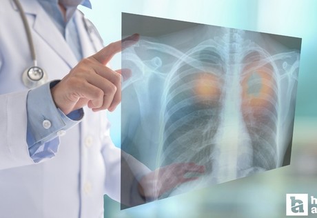 Yozgat'ta kanser taramaları ile kanserin erken teşhis edilmesi amaçlanıyor