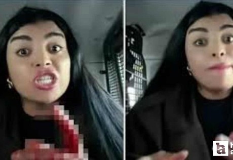 TİKTOK fenomeni Karagül'ün canlı yayını kanlı bitti: Genç kadını yüzünden bıçakladı