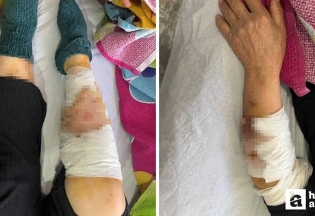 Ayaş'ta köpek saldırısına uğrayan yaşlı kadın ağır yaralandı!