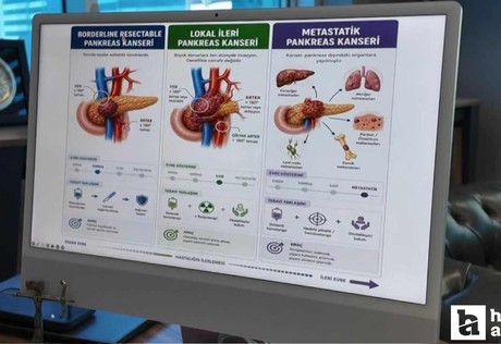 Pankreas kanserinde büyük başarı: Tedavi edilemez denen hastalara yeni umut!