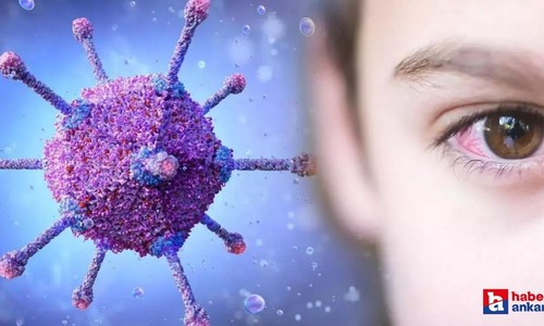 Adenovirüs nedir, bulaşıcı mı, belirtileri nelerdir?