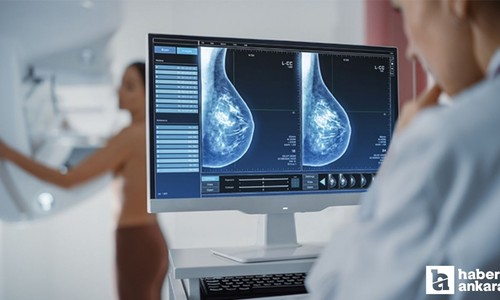 Mamografi çektirirken nelere dikkat edilmeli, çektirmeye giderken neler yapmalı?
