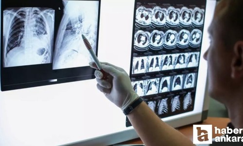 10 yıldan uzun süre sigara kullananlarda KOAH riski artıyor