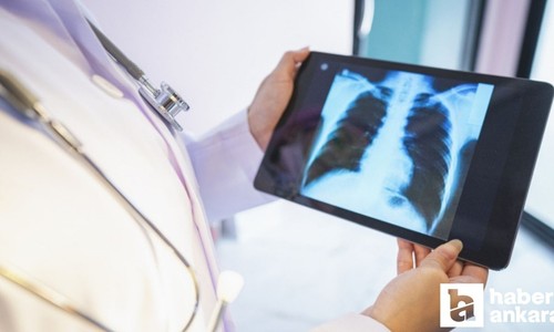 Zatürre hastalığı için 7 risk faktörü sıralandı