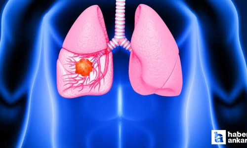 6 aylık ömrü kalan kanser hastasından uyarı! Bu belirtileri gözardı etmeyin