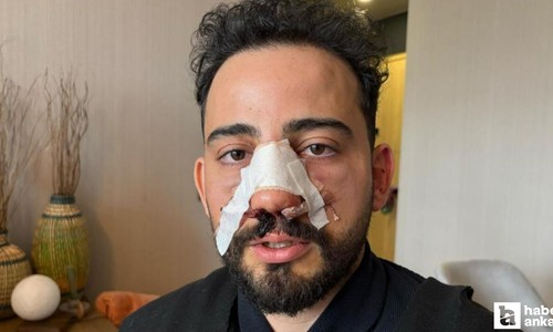 Ankara'da siparişi geç gelince restoranı terk eden müşteriyi personeller darp etti