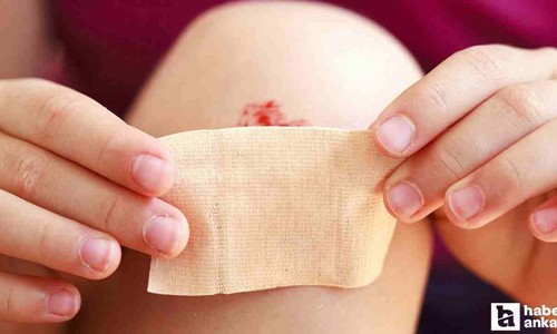 Hemofili hastalarının doğru tedaviyle sağlıklı ömür sürmesi mümkün