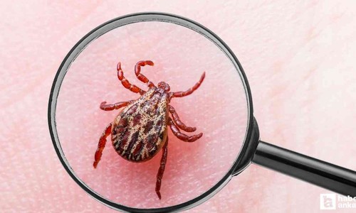 Kene ısırığı sonrasında ilk 10 güne dikkat!